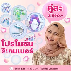 ทำรีเทนเนอร์